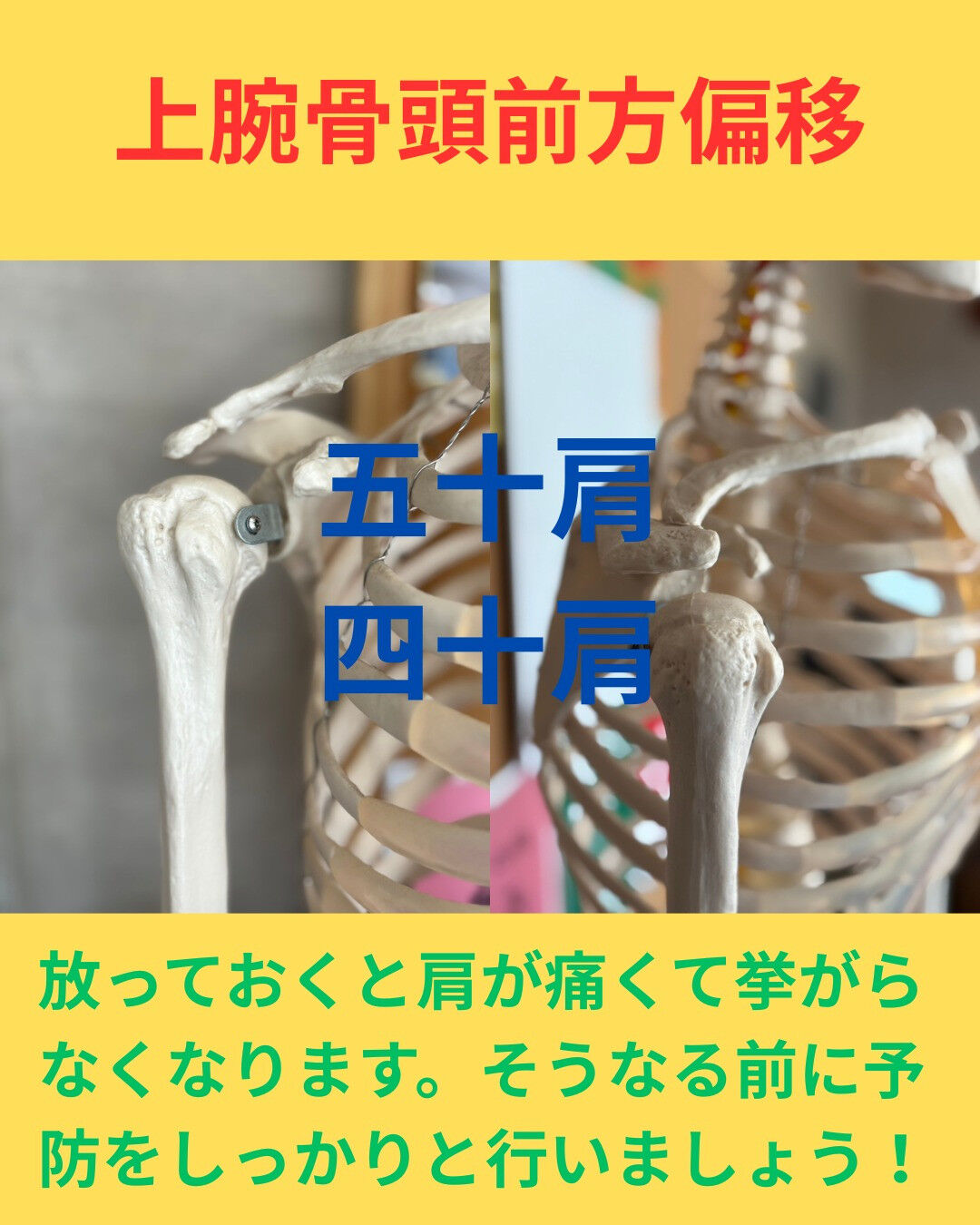 肩が痛くて挙がらない😣