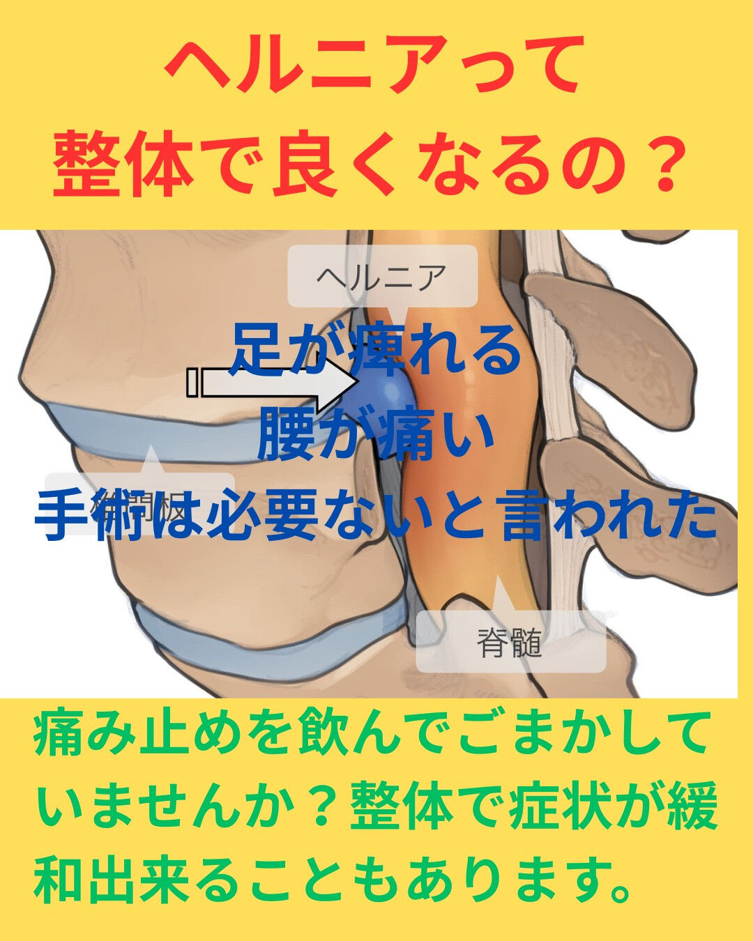 腰椎椎間板ヘルニア 😣、手術は必要ないと言われても、日常生活