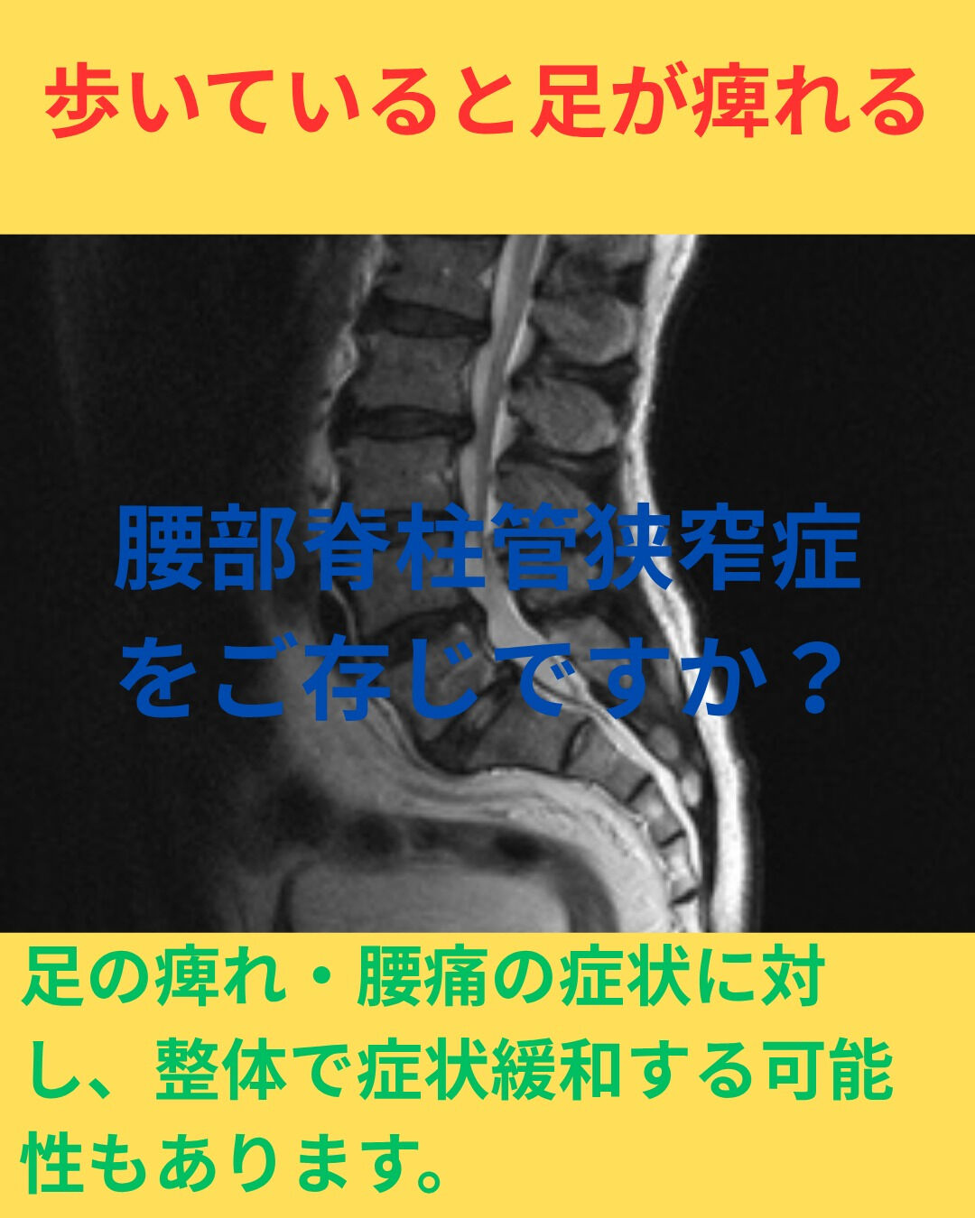 腰部脊柱管狭窄症はどのような症状がみられるのかご存じですか？