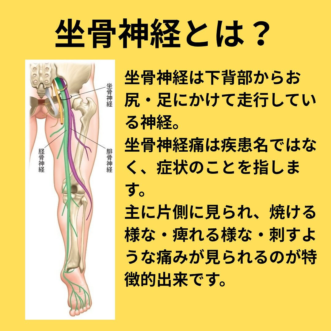 「坐骨神経痛」解説編