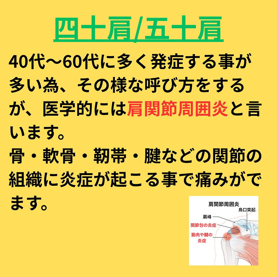 「五十肩/四十肩」解説編！
