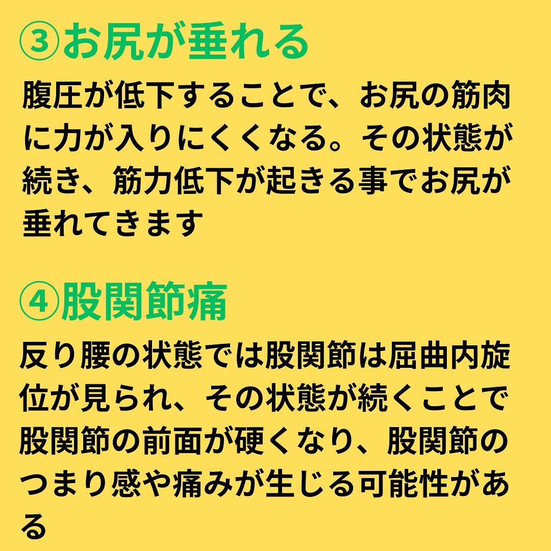 反り腰が体に及ぼす影響