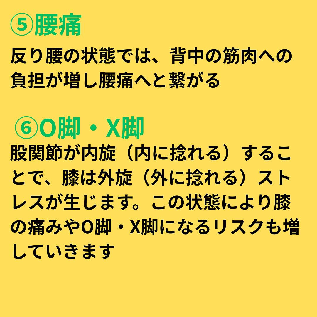 反り腰が体に及ぼす影響