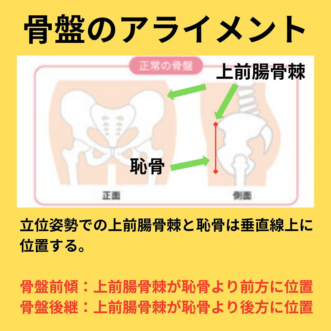 「姿勢が悪いから正しなさい！！」