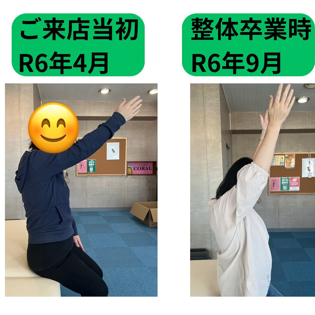 「肩関節周囲炎の整体卒業後の経過」
